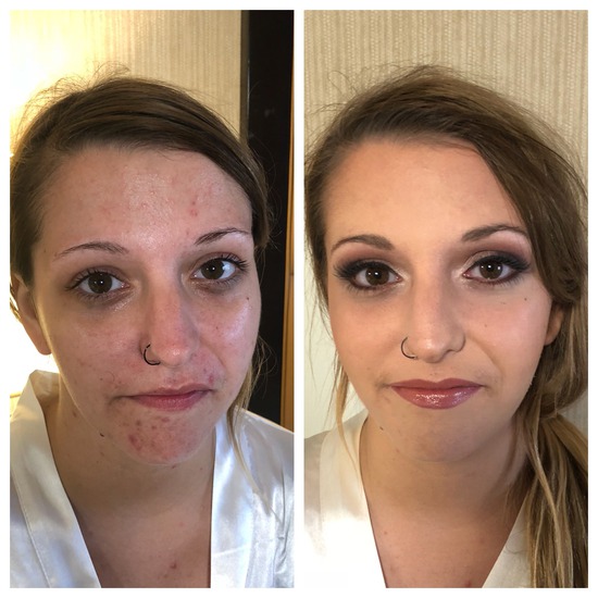 Before and After transformation