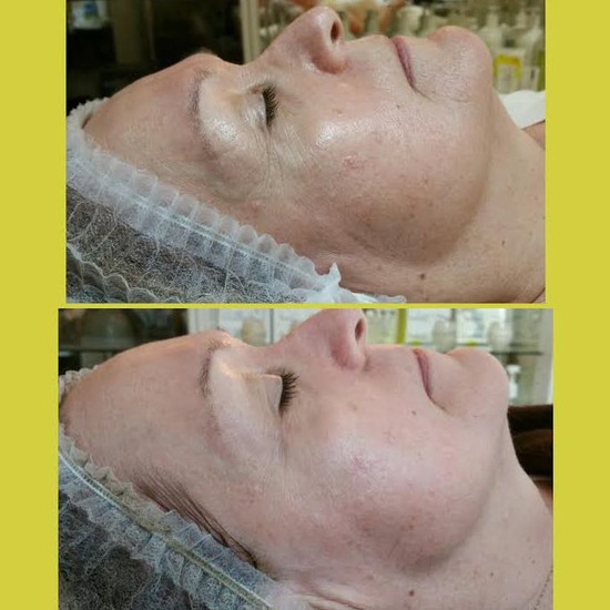 Serenity Skin Care Studio on OneWed