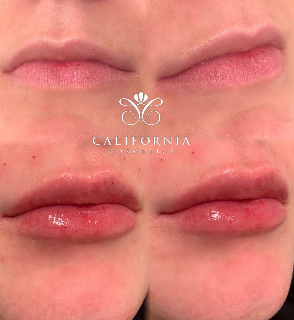 Lip enhancement at California Cosmetics